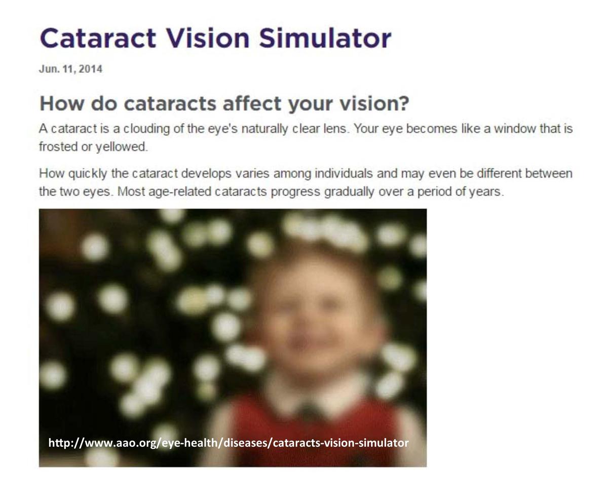 How Do I Know If I Have Cataracts?
