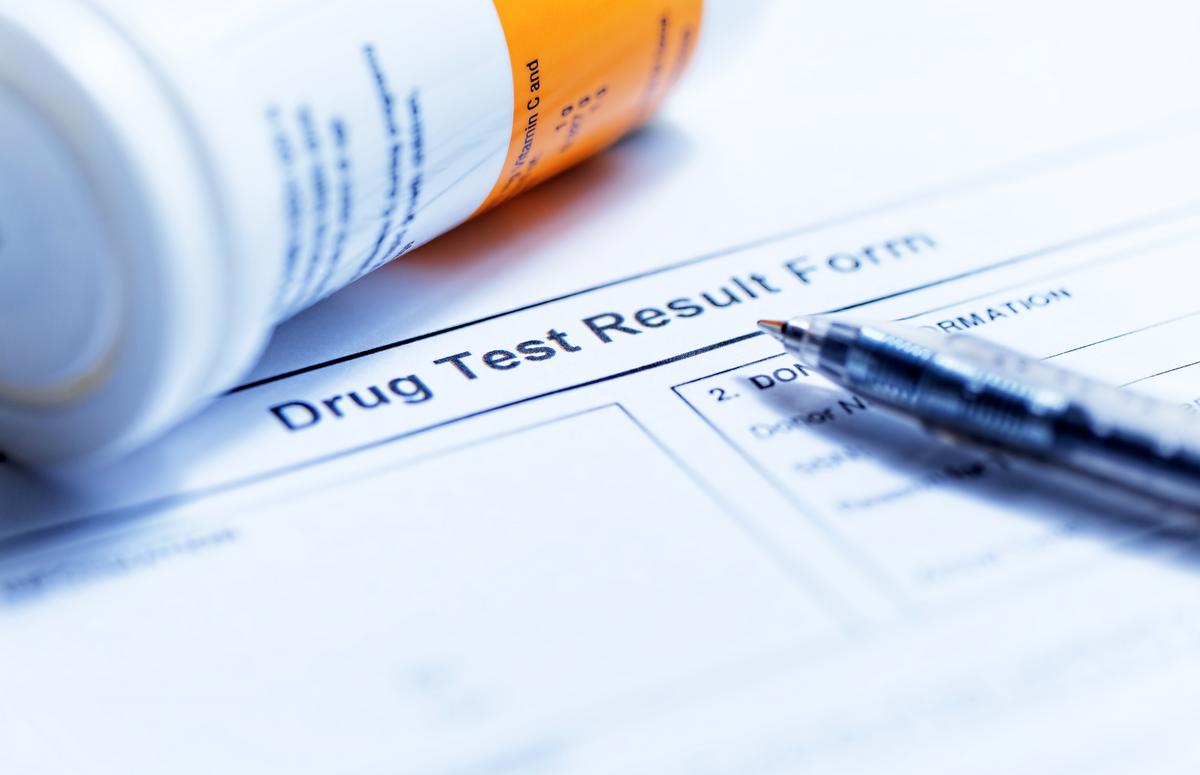 Which Specimen Should You Choose? Saliva vs. Urine Drug Tests